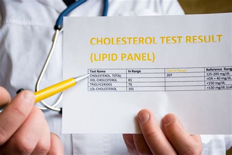 Image result for Lipid Panel Exam Papers