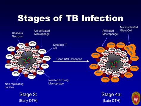 Image result for Tuberculosis Latent Stage
