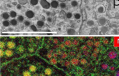 Image result for Electron Microscope Images Color