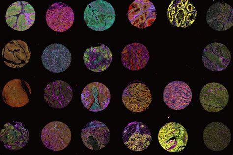 Image result for Cosmic Tissu Microarray Spatial
