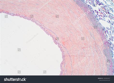 Image result for Hypophyseal Artery Under Microscope