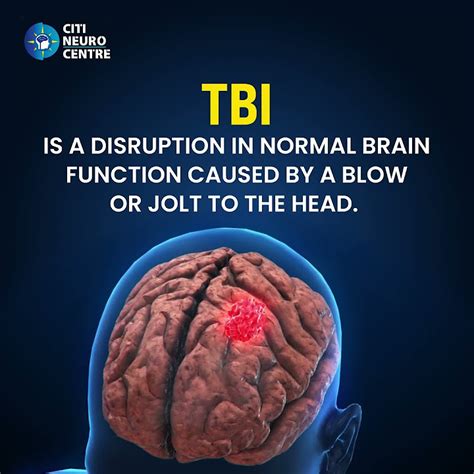 Afbeeldingsresultaten voor TBI Tips