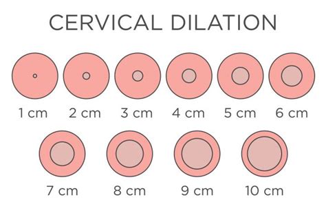 Afbeeldingsresultaten voor How to Check Cervix Visual