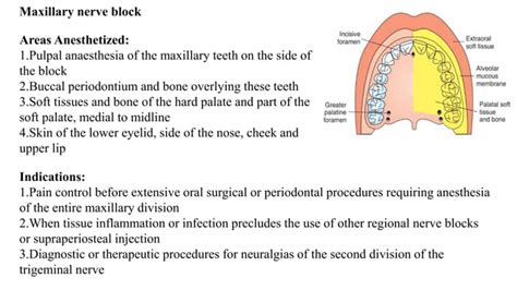 Image result for Maxillary Nerve Block