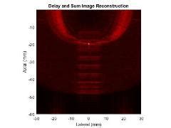 Iteratively Corrected Delay and Sum Algorithm for Image Reconstruction に対する画像結果