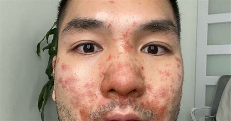 Image result for Monkey Popping in Human