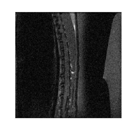 Image result for Spine Segmentation Python