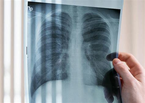 Image result for Normal Problems