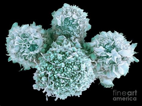 Image result for Dendritic Cells in Microscope