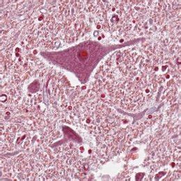 Image result for LAN LED Multipolar Neuron