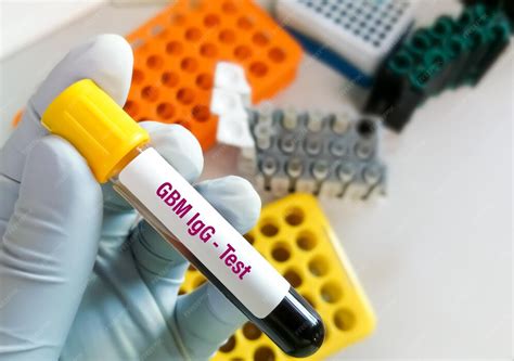 Image result for Test Lab IG BBG