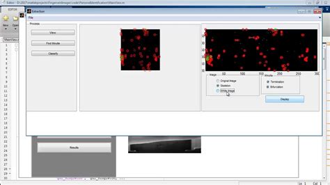 Image result for Vein Diameter Finding Methods Using MATLAB