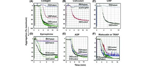Image result for Normal Platelet Aggregation Graph