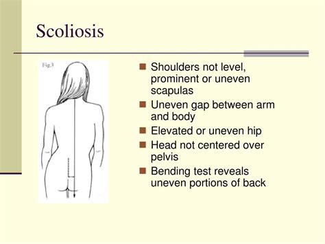 Image result for Normal Back Curve