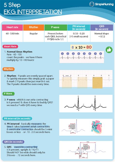 Easy ECG Guide に対する画像結果