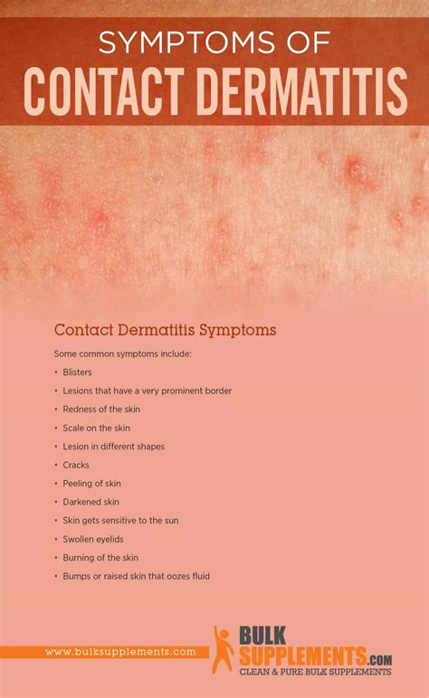 Rhus Dermatitis Face-এর ছবি ফলাফল