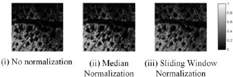 Image result for Intensity Normalization