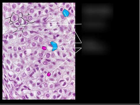 How to Identify Elastic Cartilage に対する画像結果