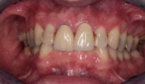 Restricted Envelope of Function に対する画像結果