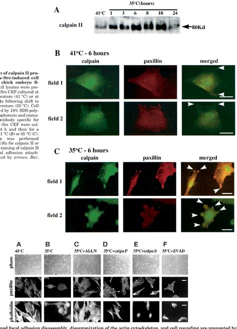 Afbeeldingsresultaten voor Focal Adhesion Kinase