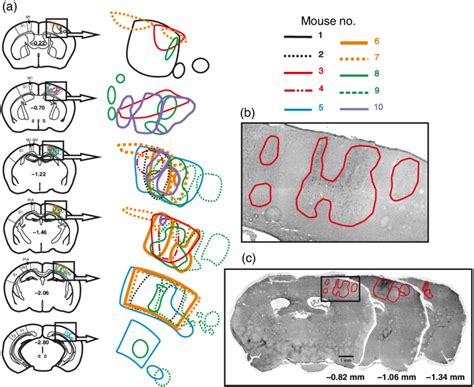 Afbeeldingsresultaten voor Secondary Motor Cortex