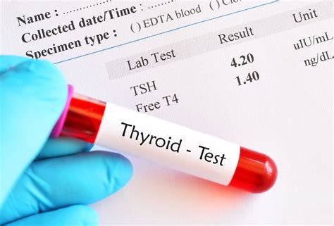 Image result for Thyroid Lab Test Form