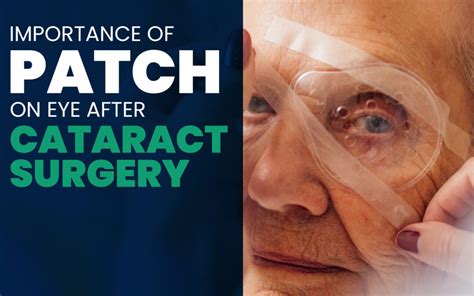 Image result for Post Cataract Check