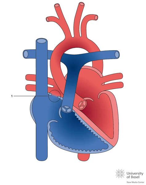 Toradh íomhá ar Ruis Atrium Septum Defect