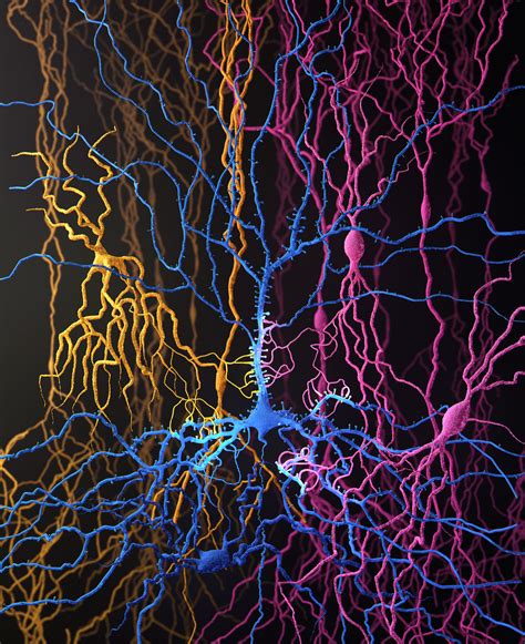 Toradh íomhá ar Visual Cortex Max Olujobi