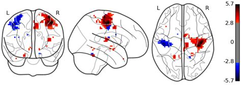 Python Glass Brain に対する画像結果