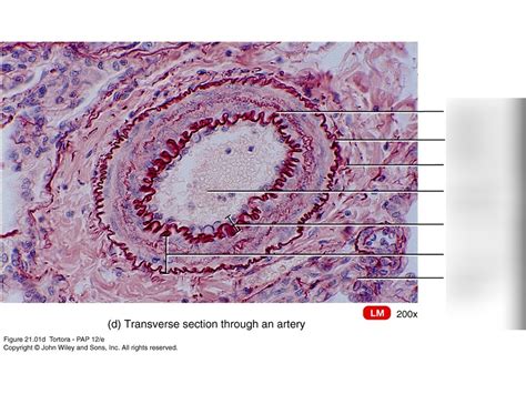 Transverse Section of Vein and Artery に対する画像結果