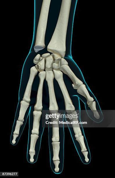 Image result for Left Hand Navicular Bone Anatomy