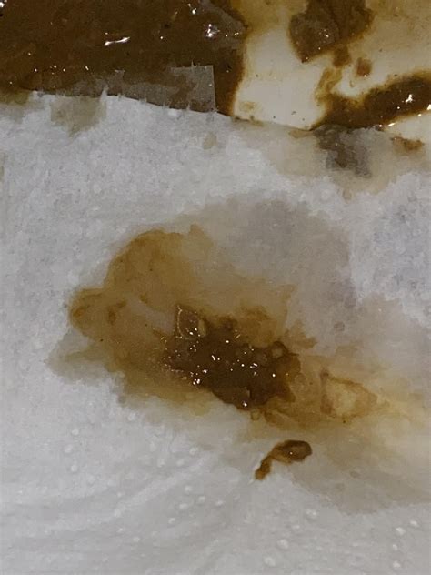 Parasites in Human Poop に対する画像結果