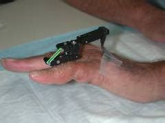 Toradh íomhá ar Digit Widget Finger