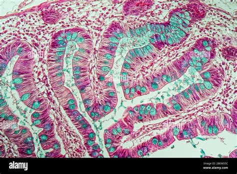 Image result for Small Intestine Microscopic View