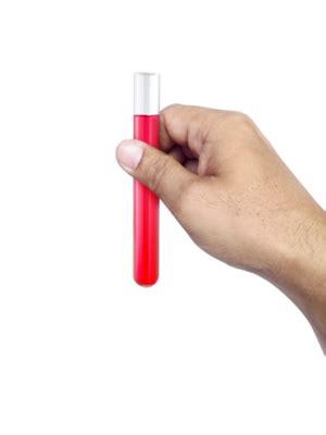 Blood Test Image PNG No Background に対する画像結果