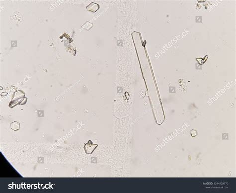 Toradh íomhá ar Triple Phosphate 5S rRNA