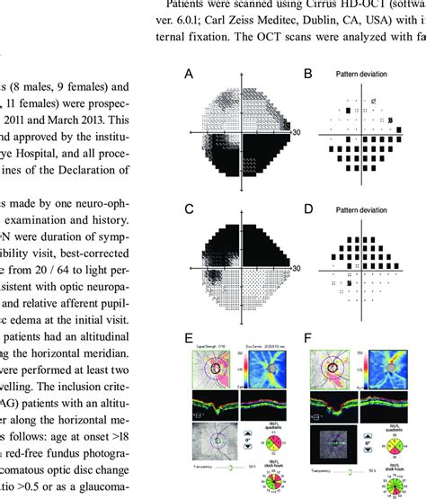 Toradh íomhá ar How Visual Field Testing Is Done