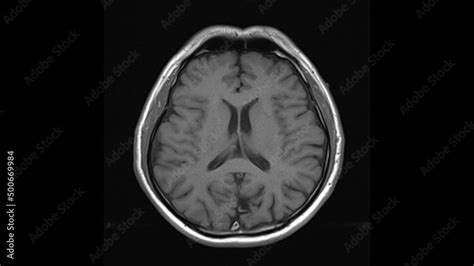 Image result for Normal MRI Axial View