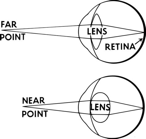Toradh íomhá ar Eye Diagram That Shos Distant Light Refraction