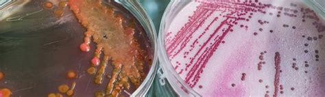 Water Testing / Treatment/ DI Water | WTL Ireland