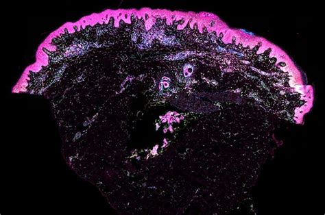 Image result for Human Skin Normal Map