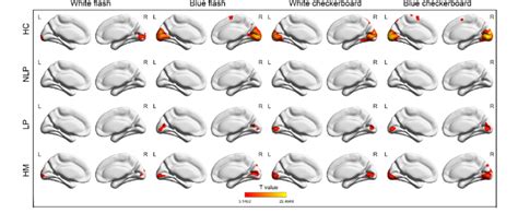 Visual Cortex Activation Map に対する画像結果