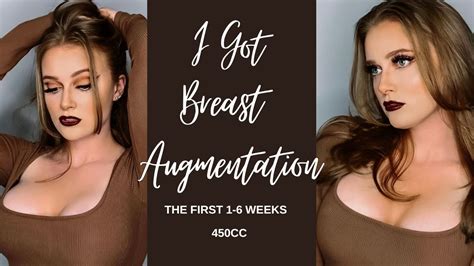 Image result for My Augmentation 450Cc