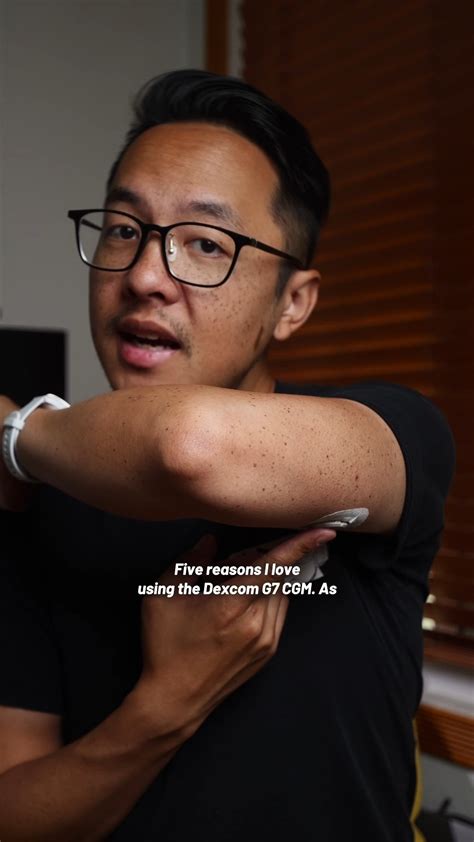 Afbeeldingsresultaten voor Dexcom Sensor Placement