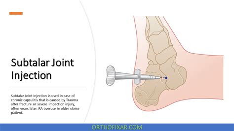 Image result for Subtalar Joint Injection vs Sinus Tarsi