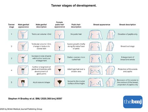 Image result for Delayed Puberty