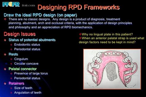 How to Load a RPD に対する画像結果