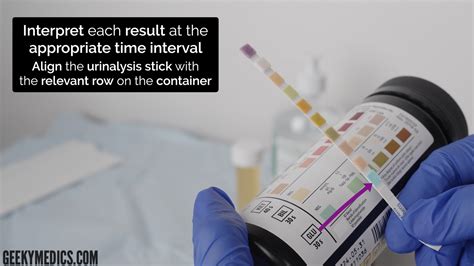 Afbeeldingsresultaten voor Dipstick Urinalysis