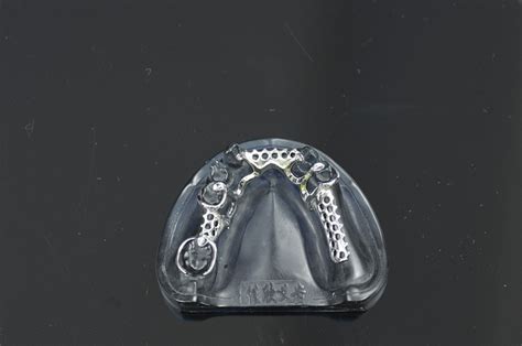 Image result for Python Dents